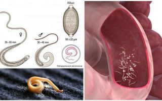 Jak odstranit pinworms u dospělých a dětí