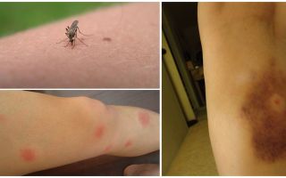 Proč zůstávají modřiny po kousnutí komárů?