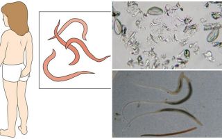Co je to pinworms a jak vypadají