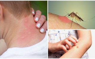 Proč komár kousne svědění