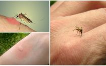 Proč komáři kousají některé lidi více než ostatní