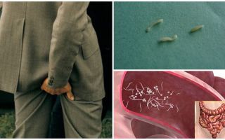Léčba lidových prostředků pinworms